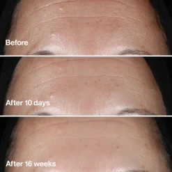 Clinique Smart Clinical Repair Serum Kopen