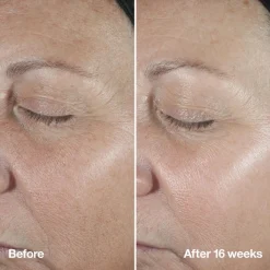 Clinique Smart Clinical Repair Serum Kopen