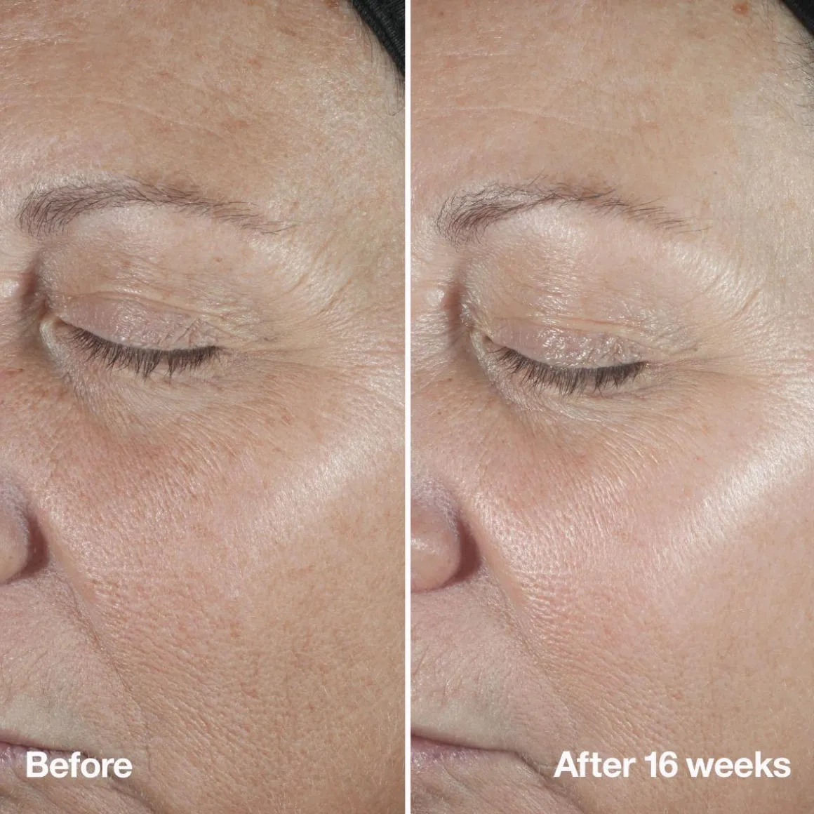 Clinique Smart Clinical Repair Serum Kopen
