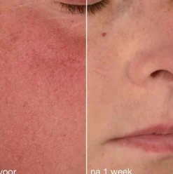 Dermalogica Stabilizing Repair Cream Kopen