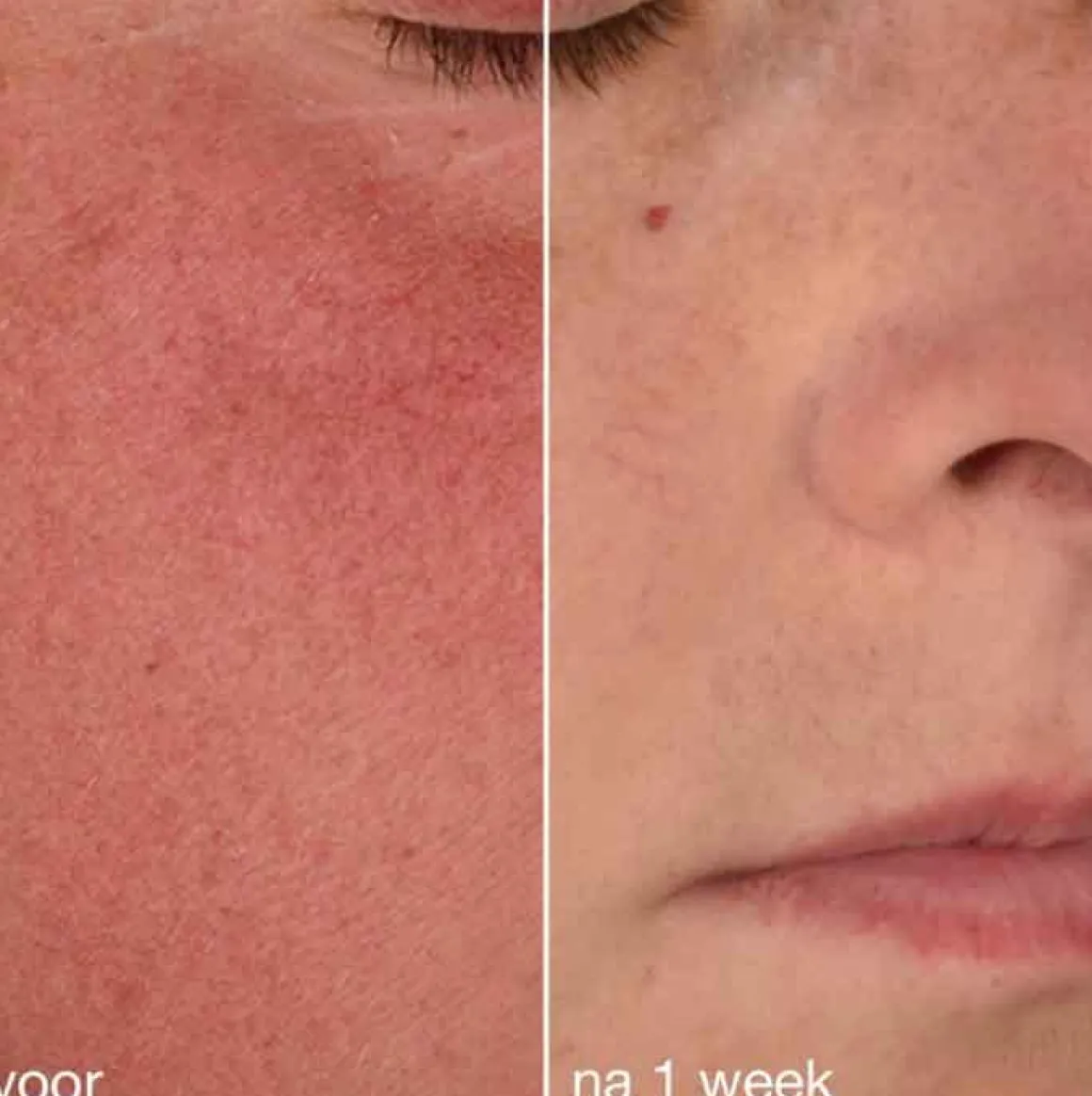 Dermalogica Stabilizing Repair Cream Kopen