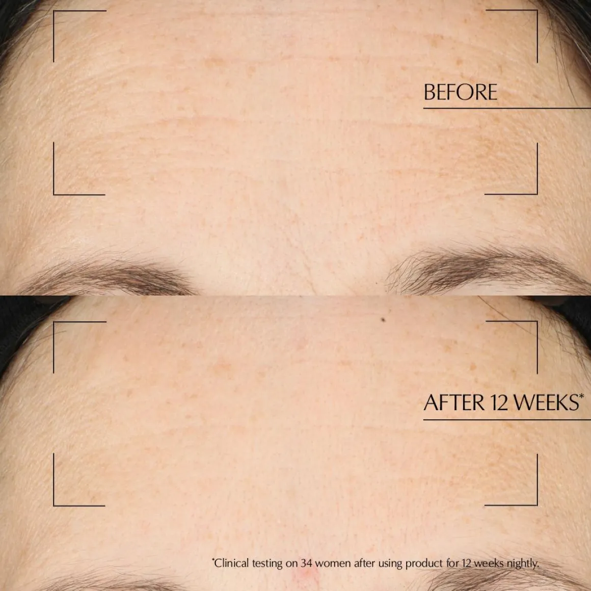 Estee Lauder ANR Overnight Treatment Kopen