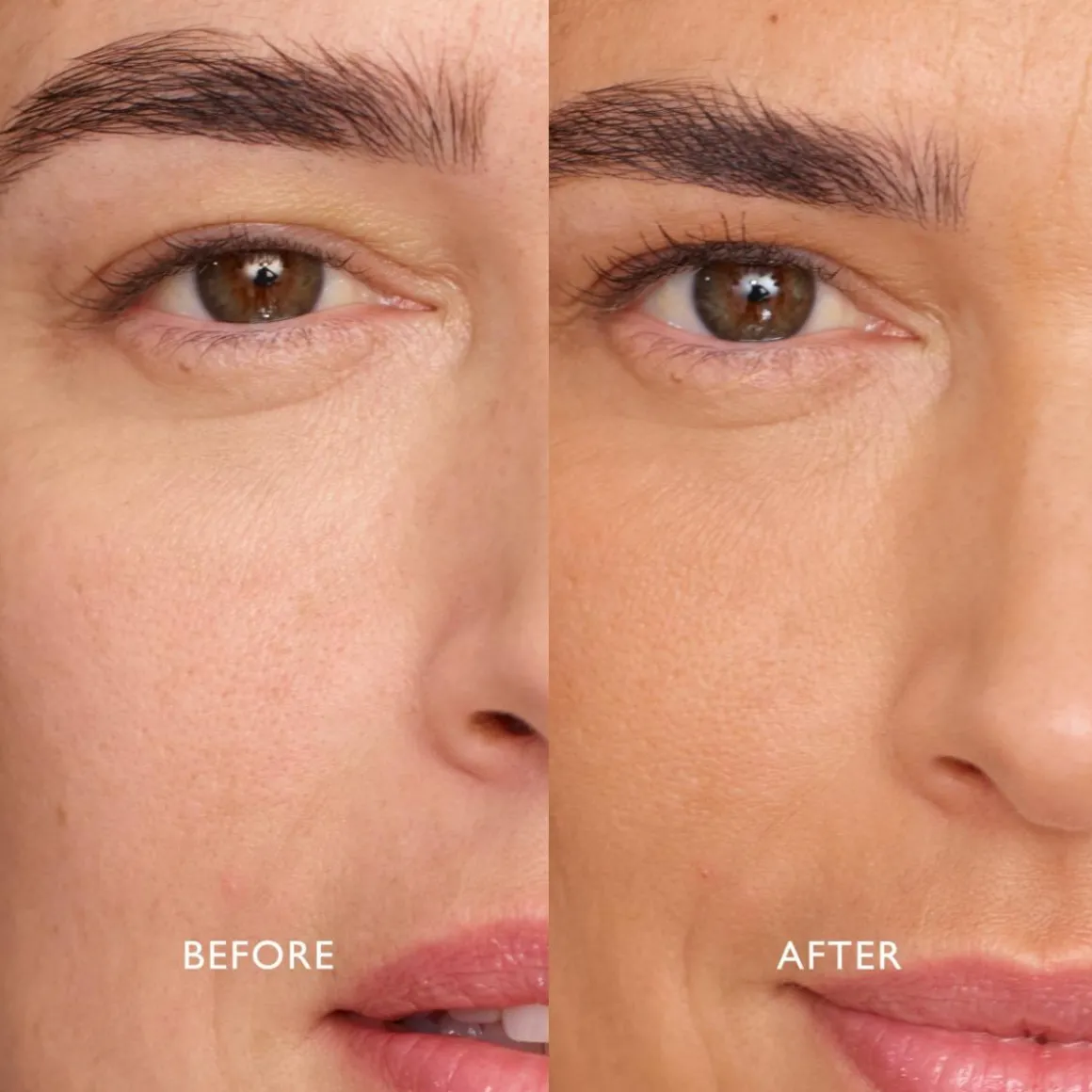 Infinite Bronze Tinted Protection Sunlight