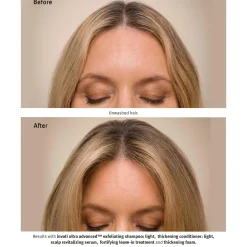 Invati Ultra Advanced Revitalizing Scalp
