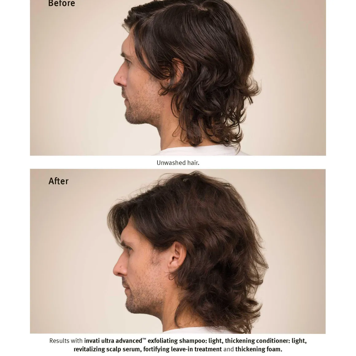 Invati Ultra Advanced Revitalizing Scalp