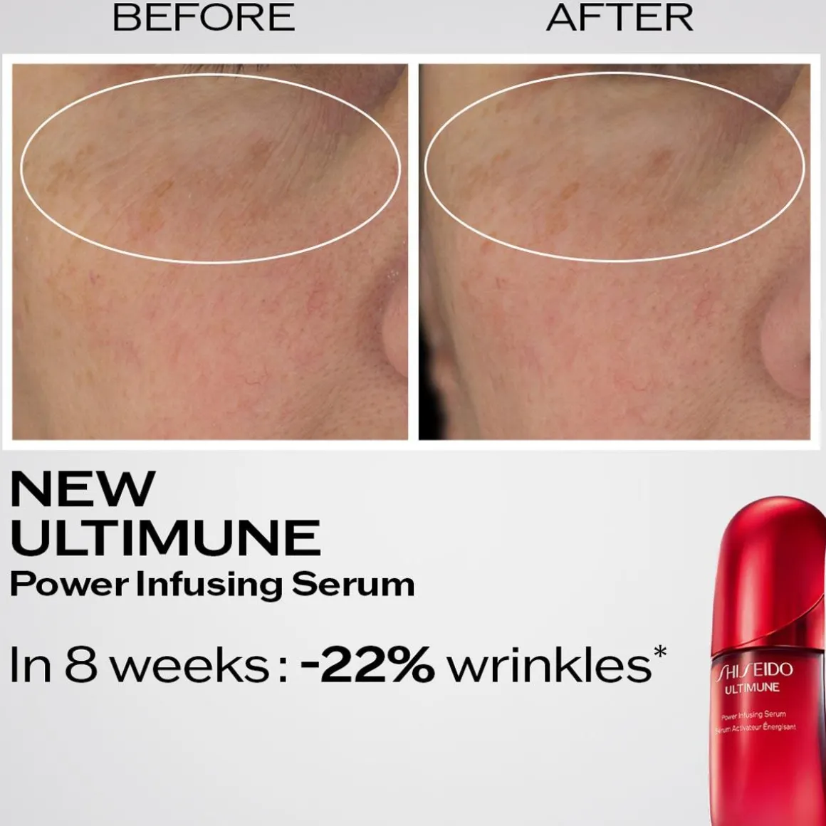 Ultimune Power Infusing Serum Refill Kopen